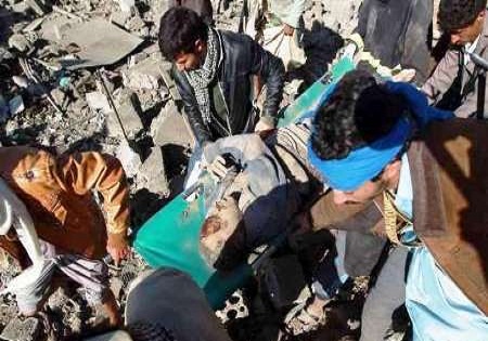 مرگ ده‌ها کودک یمنی بر اثر استنشاق گازهای سمی/ افزایش تلفات سعودی در جنگ تحمیلی علیه یمن